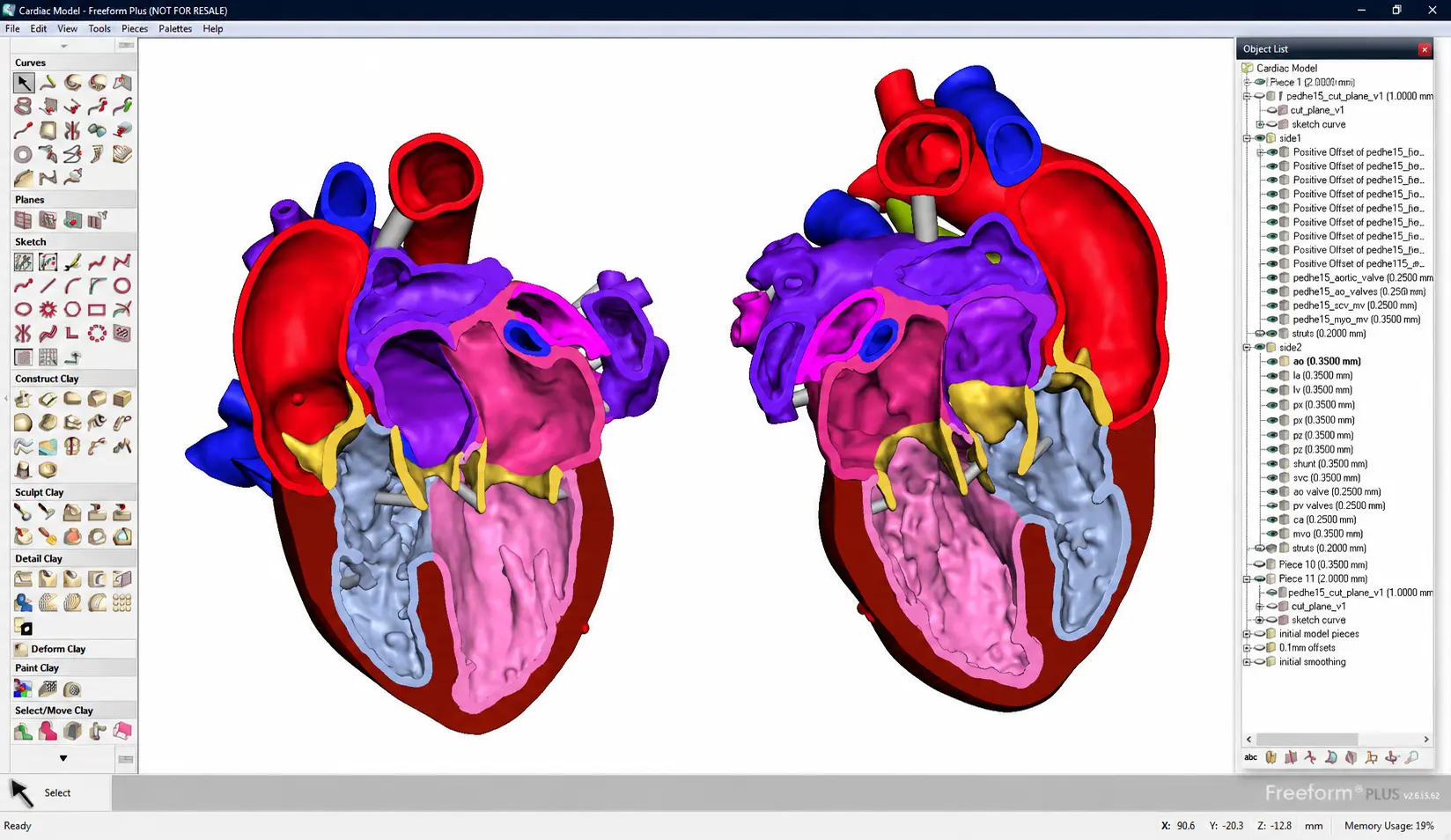 Modèle anatomique 3D du cœur affiché dans un logiciel de conception médico-chirurgicale pour la planification d'une intervention personnalisée.